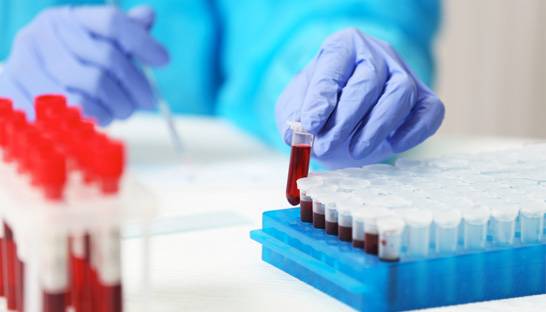 PA Consulting patent paves way for Point of Care testing